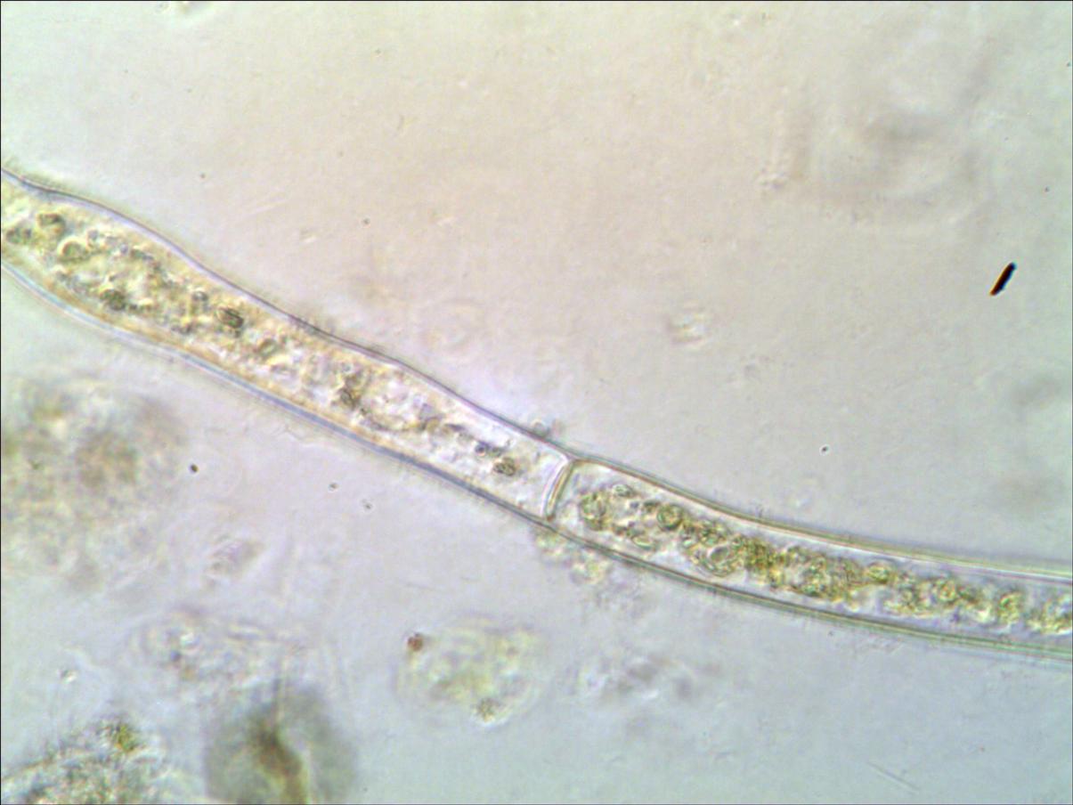 Klicke auf die Grafik für eine größere Ansicht

Name:	Blaualge__04.jpg
Hits:	3234
Größe:	90,1 KB
ID:	2048